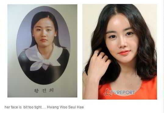 hwang woo seul hye