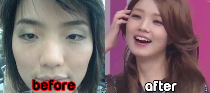 ahn young mi before and after 654654