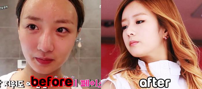 bomi before and after t56565