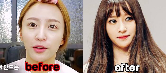 hani before and after