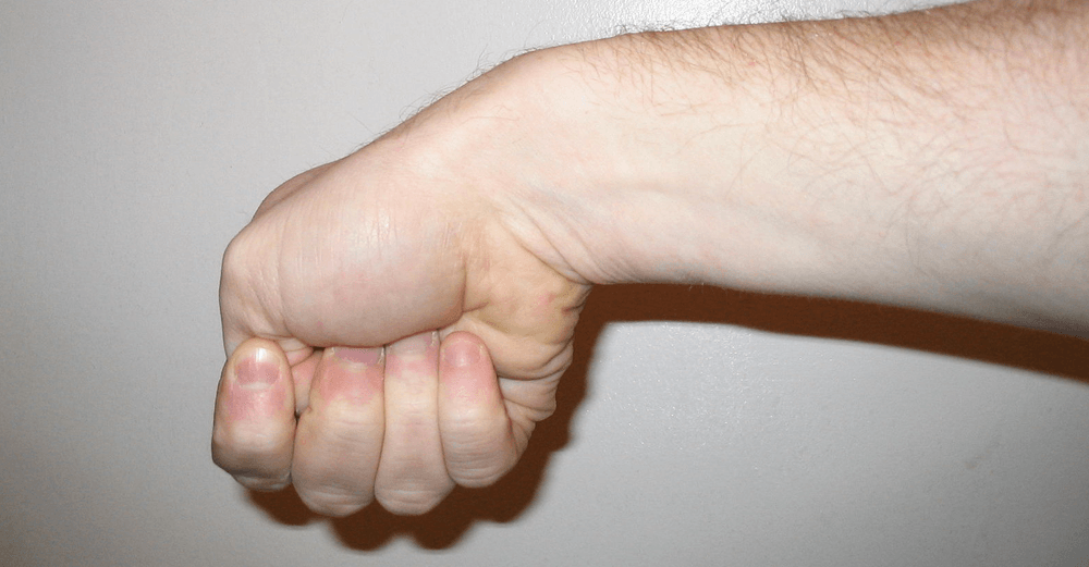 Тендинит сухожилия пальца
